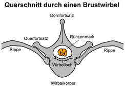 tnbrust2.gif