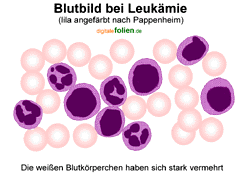 Bild vergrößern!